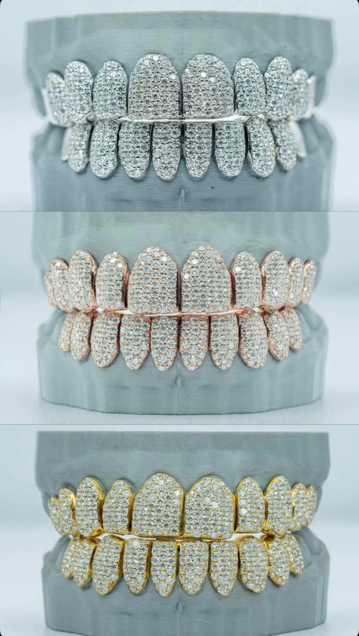 VVS1 GRILLS