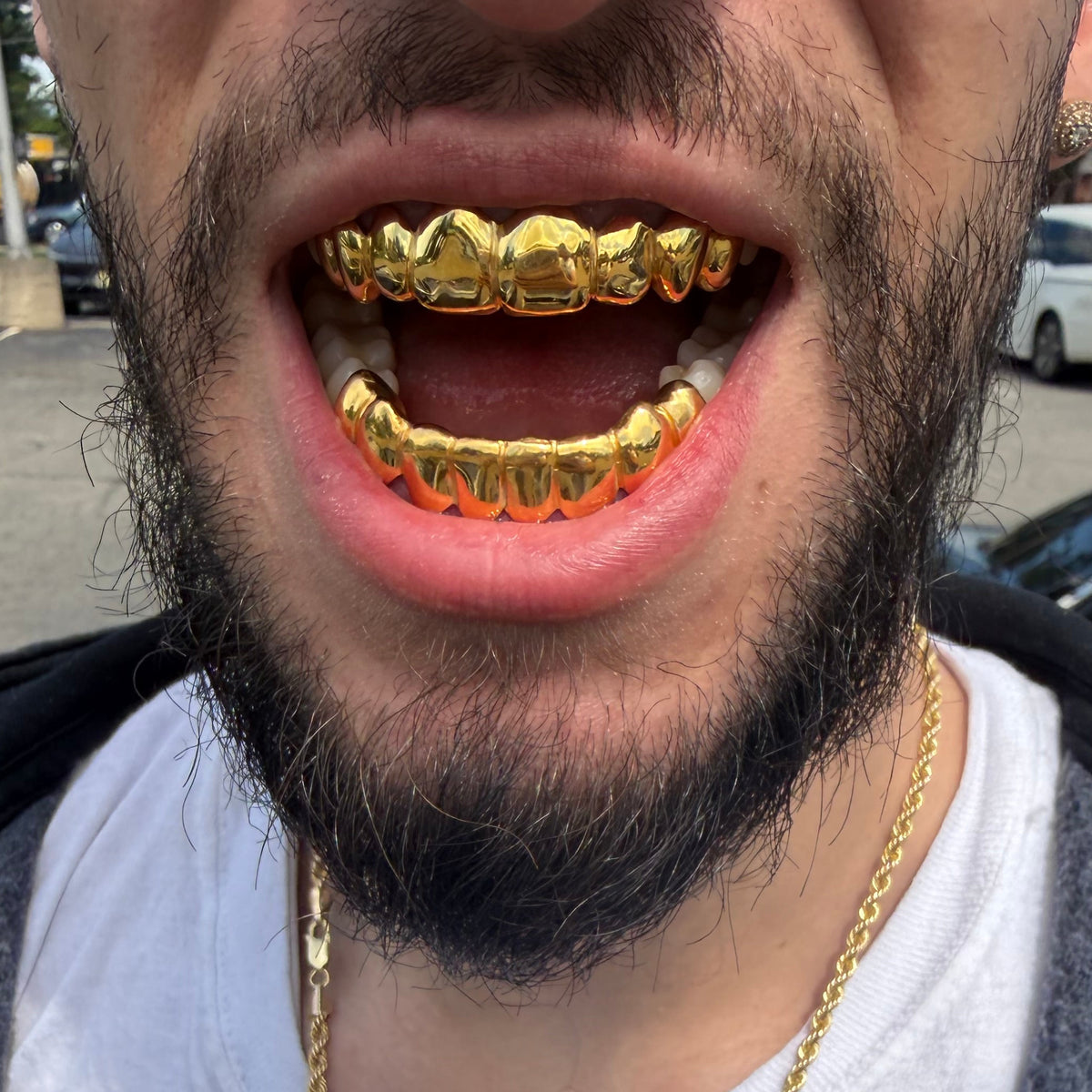 14K GOLD GRILLS